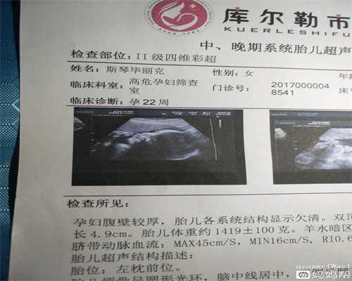 职场代孕怎样调节心理压力_上海试管婴儿医院