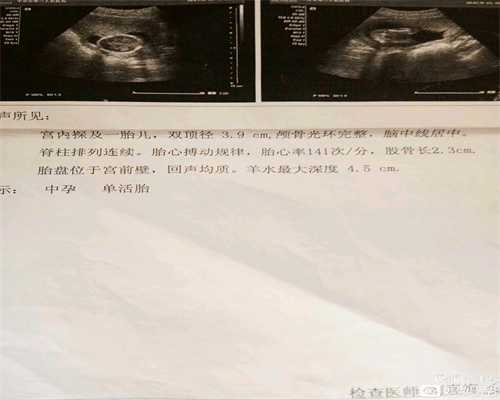 代孕因时择食 一年四季该怎么吃_北京代孕合法吗