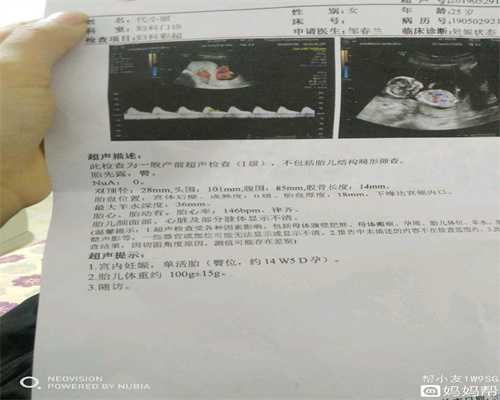 代孕多喝水可防尿路感染_北京找人供卵合法吗