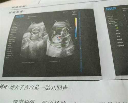 北京代孕机构哪家最专业_北京供卵代生小孩_有怀