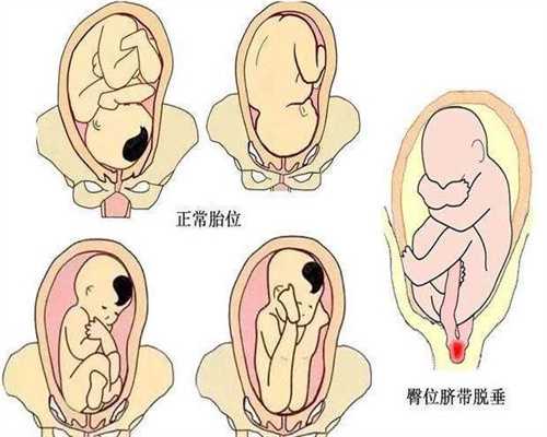 北京代生小孩公司_代生一孩子收费20万_孕妇睡觉