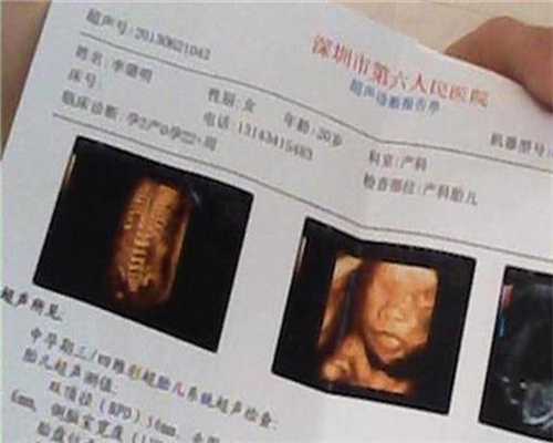 北京世纪助孕最低价格_找女人代生孩子多少钱