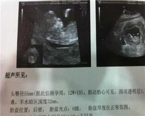 北京正规代孕费用_40岁头胎晚育的危害有哪些