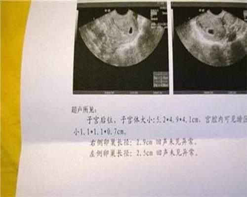 北京正规代孕费用_40岁头胎晚育的危害有哪些