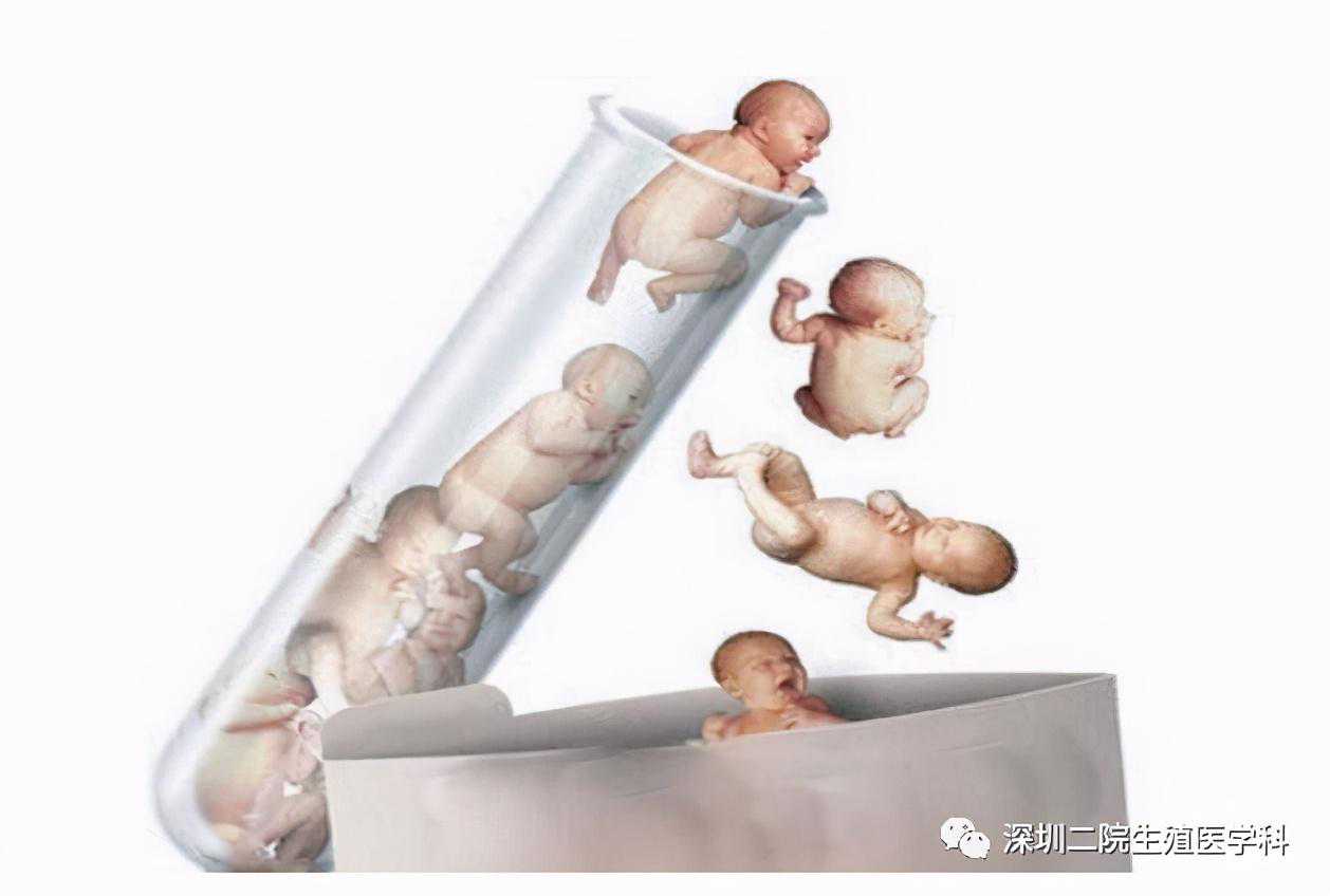北京代孕专家_辅助生殖常见问题之-试管婴儿篇