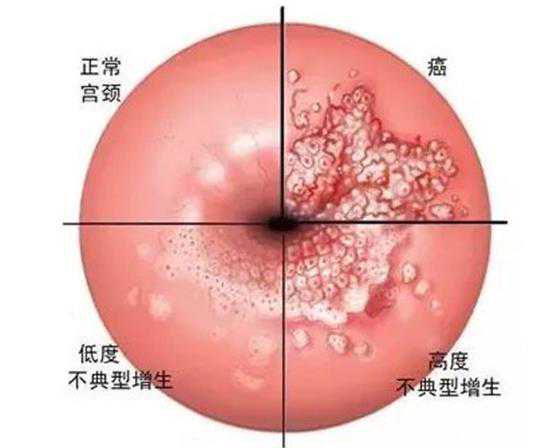 北京助孕是怎么样的 在北京协和做试管可以报销吗? ‘孕晚期b超男女区别图’